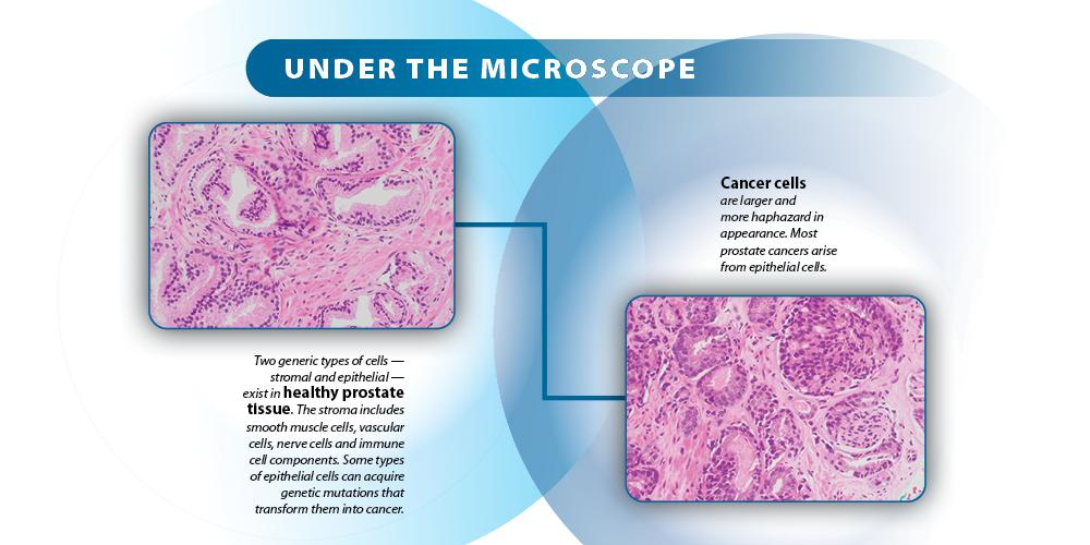 (photos of cancer cells provided by Gustavo de la Roza, MD)