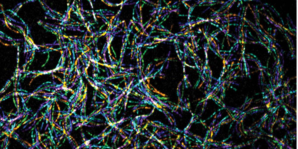 The protein actin, shown in this microscopic image using temporal color coding (see final paragraph for details). Image courtesy of Brian Haarer, Morgan Pimm, Ebbing De John, David Amberg and Jessica Henty-Ridilla